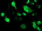 Signal Sequence Receptor Subunit 1 antibody, TA503268, Origene, Immunofluorescence image 