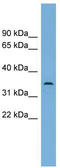 Chromosome 3 Open Reading Frame 49 antibody, TA337642, Origene, Western Blot image 