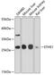 ETHE1 Persulfide Dioxygenase antibody, GTX64809, GeneTex, Western Blot image 