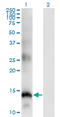 Secretory Leukocyte Peptidase Inhibitor antibody, LS-C198222, Lifespan Biosciences, Western Blot image 