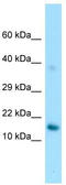 Glycosylphosphatidylinositol Anchored High Density Lipoprotein Binding Protein 1 antibody, TA337743, Origene, Western Blot image 