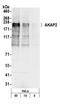 A-Kinase Anchoring Protein 2 antibody, A301-363A, Bethyl Labs, Western Blot image 