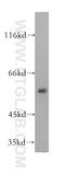 DLD antibody, 16431-1-AP, Proteintech Group, Western Blot image 