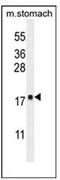 Dynein Light Chain Roadblock-Type 2 antibody, AP51348PU-N, Origene, Western Blot image 