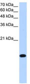 Basic Leucine Zipper ATF-Like Transcription Factor 2 antibody, TA342492, Origene, Western Blot image 