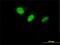 DnaJ homolog subfamily C member 7 antibody, H00007266-M01, Novus Biologicals, Immunofluorescence image 