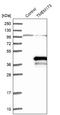 MITA antibody, NBP2-48684, Novus Biologicals, Western Blot image 