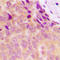 NADH:Ubiquinone Oxidoreductase Subunit S5 antibody, LS-C368435, Lifespan Biosciences, Immunohistochemistry paraffin image 