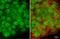 DNA Cross-Link Repair 1C antibody, GTX636575, GeneTex, Immunocytochemistry image 