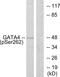 GATA Binding Protein 4 antibody, PA5-38493, Invitrogen Antibodies, Western Blot image 