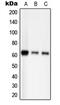 P21 (RAC1) Activated Kinase 2 antibody, GTX55101, GeneTex, Western Blot image 