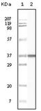 BLK Proto-Oncogene, Src Family Tyrosine Kinase antibody, AM06138SU-N, Origene, Western Blot image 
