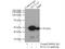 Succinate-CoA Ligase ADP-Forming Beta Subunit antibody, 12627-1-AP, Proteintech Group, Immunoprecipitation image 