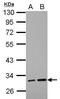 Leucine Rich Repeat Containing 19 antibody, PA5-32120, Invitrogen Antibodies, Western Blot image 