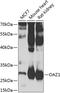 Ornithine decarboxylase antizyme 1 antibody, 22-944, ProSci, Western Blot image 