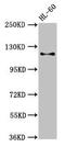 CD163 antibody, LS-C285807, Lifespan Biosciences, Western Blot image 
