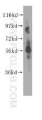 Neuronal acetylcholine receptor subunit alpha-6 antibody, 11388-1-AP, Proteintech Group, Western Blot image 