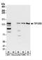 Cullin Associated And Neddylation Dissociated 2 (Putative) antibody, NBP2-22334, Novus Biologicals, Western Blot image 
