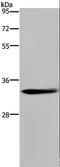 Acidic Nuclear Phosphoprotein 32 Family Member E antibody, LS-C403287, Lifespan Biosciences, Western Blot image 