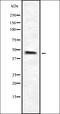 4-Hydroxyphenylpyruvate Dioxygenase antibody, orb337176, Biorbyt, Western Blot image 