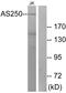 Ral GTPase Activating Protein Catalytic Alpha Subunit 2 antibody, A10416, Boster Biological Technology, Western Blot image 
