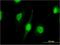 Nuclear RNA Export Factor 3 antibody, H00056000-M06, Novus Biologicals, Immunocytochemistry image 