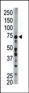 Acyl-CoA Synthetase Long Chain Family Member 6 antibody, PA5-12227, Invitrogen Antibodies, Western Blot image 