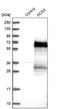 Secretogranin III antibody, NBP1-89825, Novus Biologicals, Western Blot image 