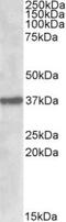 Sulfatase Modifying Factor 1 antibody, TA311608, Origene, Western Blot image 