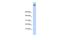 Zinc Finger Protein 644 antibody, A07102, Boster Biological Technology, Western Blot image 