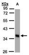 Phospholipid Scramblase 1 antibody, orb73561, Biorbyt, Western Blot image 