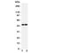 Arginine Vasopressin Receptor 1A antibody, R31372, NSJ Bioreagents, Western Blot image 