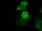 Bruton Tyrosine Kinase antibody, TA501094, Origene, Immunofluorescence image 
