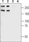 Plexin A1 antibody, PA5-77697, Invitrogen Antibodies, Western Blot image 