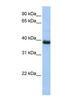 SPO11 Initiator Of Meiotic Double Stranded Breaks antibody, NBP1-58172, Novus Biologicals, Western Blot image 