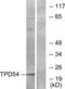 TPD52 Like 2 antibody, LS-C118678, Lifespan Biosciences, Western Blot image 