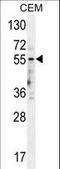 5-Hydroxytryptamine Receptor 3E antibody, LS-C155812, Lifespan Biosciences, Western Blot image 