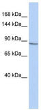 Potassium Voltage-Gated Channel Subfamily B Member 1 antibody, TA334712, Origene, Western Blot image 