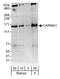 Caspase recruitment domain-containing protein 11 antibody, A302-541A, Bethyl Labs, Western Blot image 