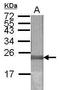 Lon Peptidase 2, Peroxisomal antibody, GTX123193, GeneTex, Western Blot image 