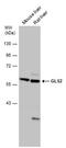 Glutaminase 2 antibody, PA5-78654, Invitrogen Antibodies, Western Blot image 