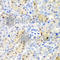 Adenosine Deaminase Domain Containing 1 antibody, A6491, ABclonal Technology, Immunohistochemistry paraffin image 