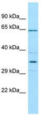Complement factor H-related protein 5 antibody, TA337960, Origene, Western Blot image 