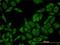 Ribosomal Protein L13 antibody, H00006137-M01, Novus Biologicals, Immunocytochemistry image 