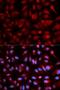 Proteasome Subunit Beta 5 antibody, LS-B12896, Lifespan Biosciences, Immunofluorescence image 