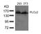Phospholipase C Gamma 2 antibody, 79-571, ProSci, Western Blot image 