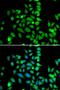 Protein Kinase AMP-Activated Non-Catalytic Subunit Beta 2 antibody, orb247703, Biorbyt, Immunocytochemistry image 