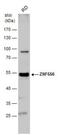 Zinc Finger Protein 556 antibody, NBP2-43598, Novus Biologicals, Western Blot image 