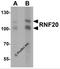 E3 ubiquitin-protein ligase BRE1A antibody, 7357, ProSci Inc, Western Blot image 