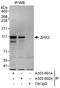 Zinc Fingers And Homeoboxes 2 antibody, A303-601A, Bethyl Labs, Immunoprecipitation image 